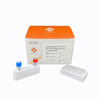 RT PCR 엔테로바이러스 71 신속 시험 장비는  dna 검출 장비를 동결건조했습니다