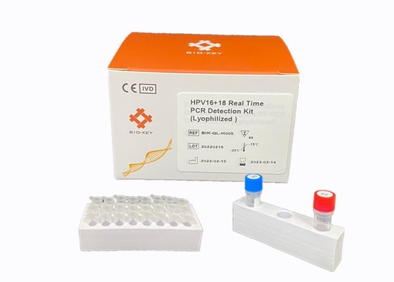 실시간 HPV PCR 장비는 HPV 바이러스 택맨 프로브 분석장치를 유전자형으로 만드는 고위험을 발견합니다